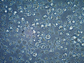 Cell Contamination Cell Contamination