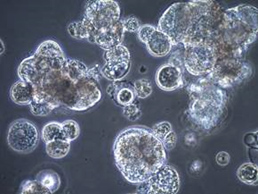 Cells in suspension may attach to one another and form clumps for a variety of reasons Cells in suspension may attach to one another and form clumps for a variety of reasons