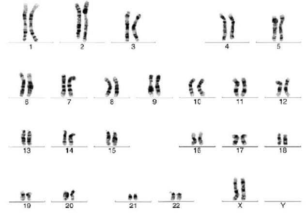 Cytogenetic analysis reveals a normal karyotype for H7 human embryonic stem cells. Cytogenetic analysis reveals a normal karyotype for H7 human embryonic stem cells.