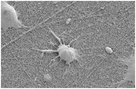 figure3 NG108神经元在Ultra-Web纳米纤维表面生长