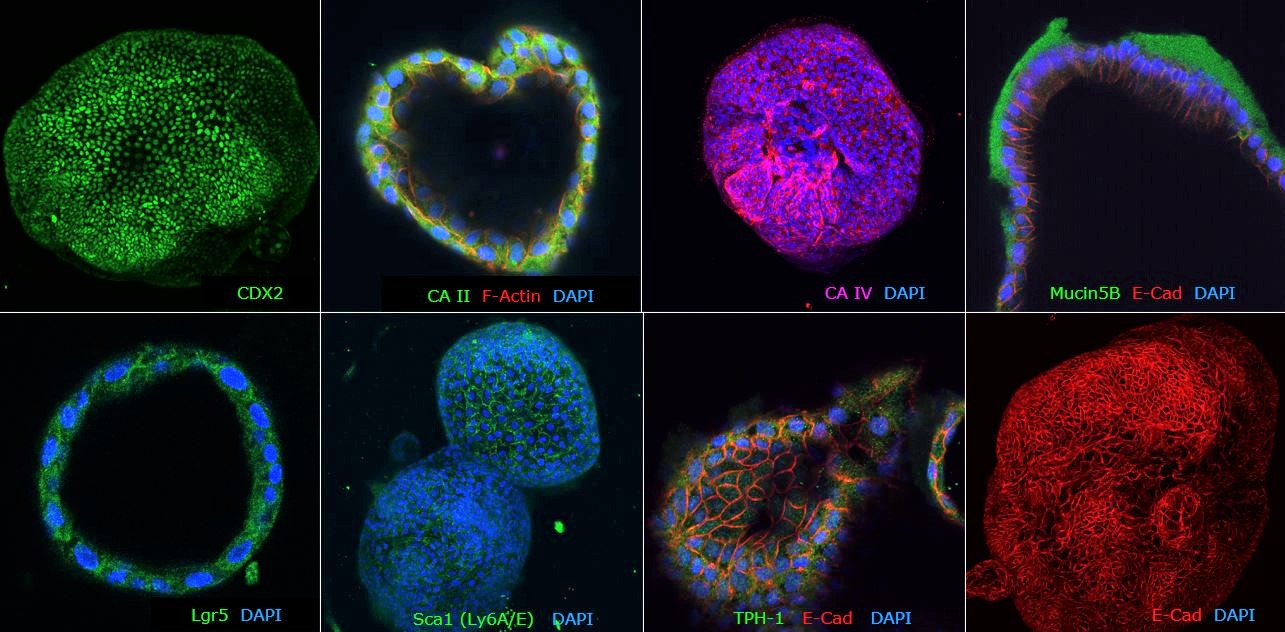 ICC Colon Organoids Immunocytochemical characterization of human colon organoids (Colon-87, SCC321). Human colon PDOs are positive for colon-specific markers: CA II, CA IV and Mucin5B, posterior hindgut marker: CDX2, stem cell markers: Lgr5 and Sca1 and epithelial markers: TPH-1 and E-Cad.