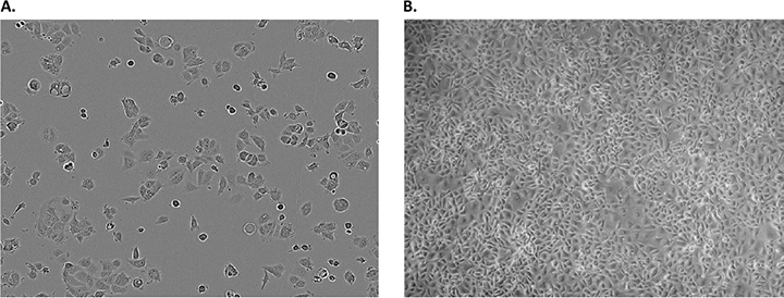Serum free cancer cell line media Morphology of MCF-7 breast carcinoma cells in the Cancer Cell Line Medium XF