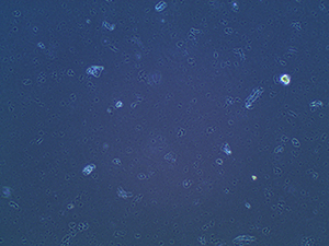Precipitation from brand new calf serum Precipitation from brand new calf serum