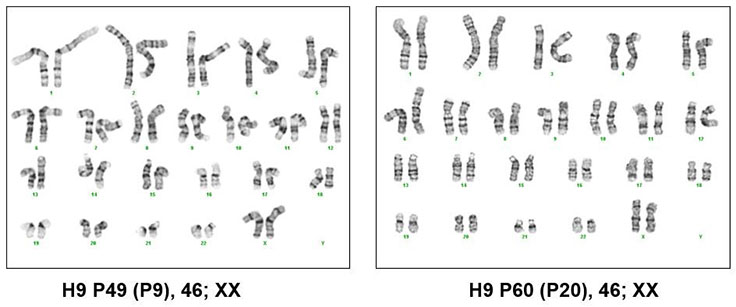 Karyotyping of pluripotent stem cells cultured in PluriSTEM™ media Karyotyping of pluripotent stem cells cultured in PluriSTEM™ media
