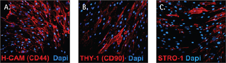 Mesenchymal Stem Cell Culture Human mesenchymal stem cell markers
