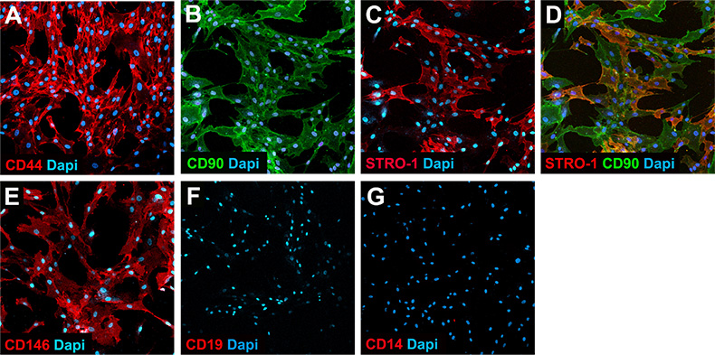 Mesenchymal Stem Cell Culture Immunocytochemical staining of cultured human bone marrow-derived mesenchymal stem cells stained