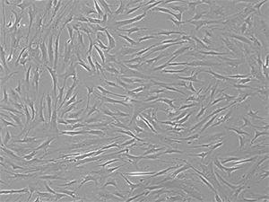 P4 bone-marrow mesenchymal stem cells grown in media containing 10% FBS P4 bone-marrow mesenchymal stem cells grown in media containing 10% FBS
