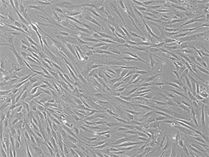 P4 bone-marrow mesenchymal stem cells P4 bone-marrow mesenchymal stem cells