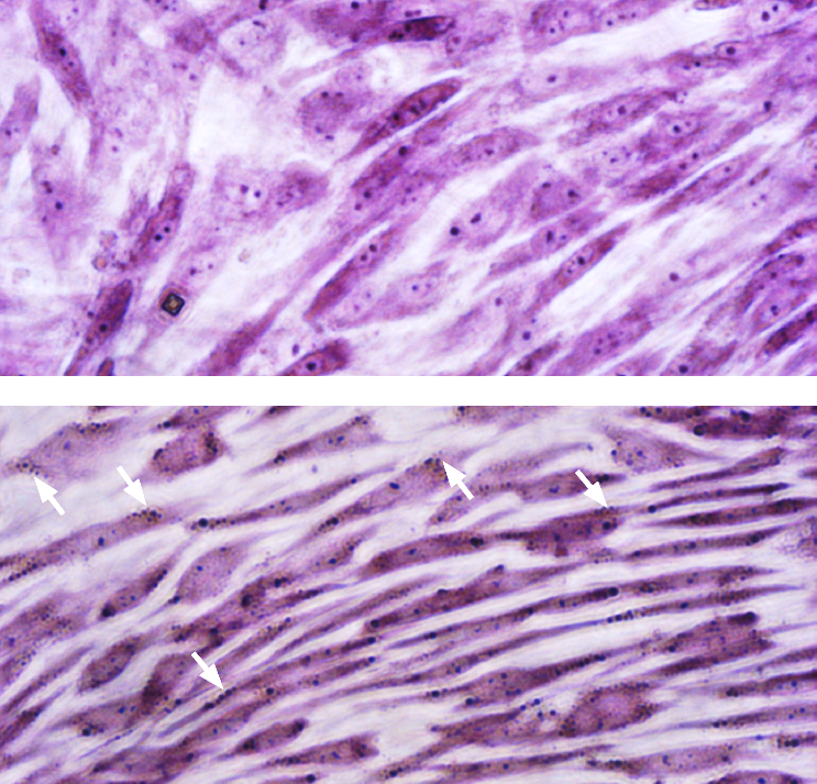 nissl-body-staining Nissl body staining of hMSC-BM derived neuron-like cells