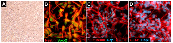 ReNcell VM Human Neural Progenitors ReNcell VM Human Neural Progenitors