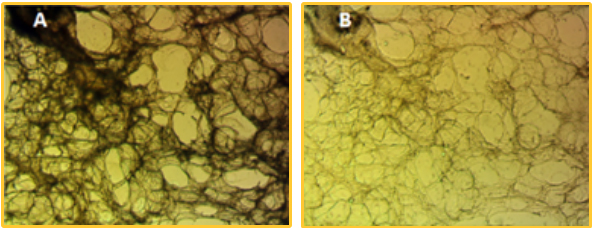 Precision cut lung slice before (left) and after (right) subjected