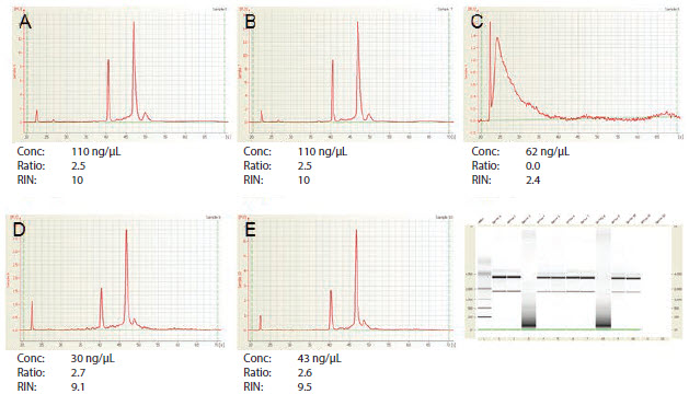 RNA样品A-E的Agilent 2100 BioAnalyzer分析 RNA样品A-E的Agilent 2100 BioAnalyzer分析