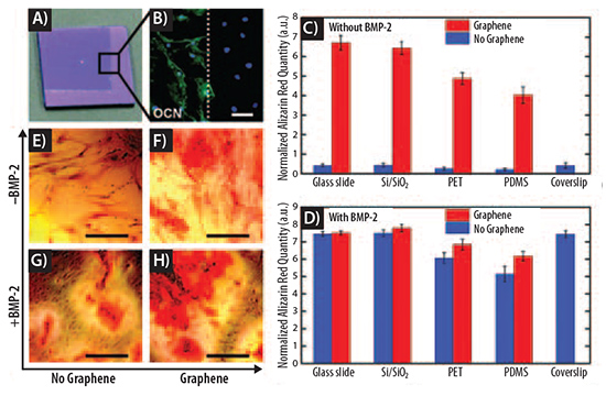 Graphene accelerates bone cell differentiation