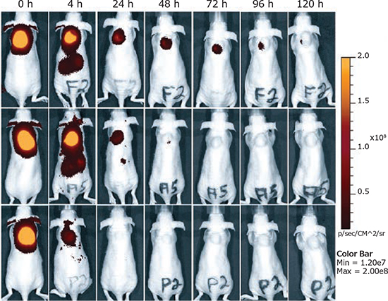 Intratumoral injection of siRNA polyplexes Intratumoral injection of siRNA polyplexes