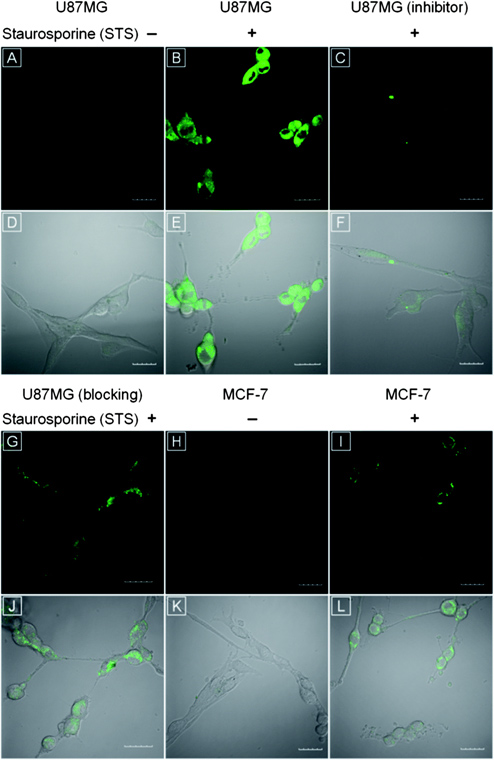 CLSM images of (A) healthy and (B) apoptotic U87MG cells upon treatment 