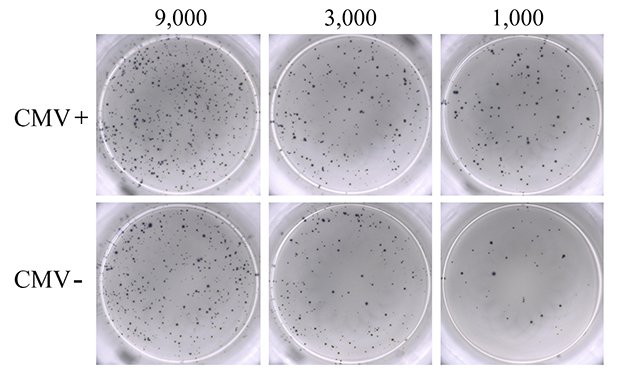 Microscopy images of wells of filter plate. The top row shows CMV positive samples at nine thousand, three thousand, and one thousand cells per well. The bottom row shows CMV negative samples at nine thousand, three thousand, and one thousand cells per well. There are more spots with higher cell number, and more spots for the CMV positive samples compared to CMV negative samples.