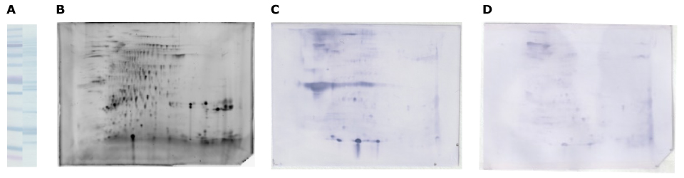 Separation Walnut Protein Extract The Auto2D system for walnut allergy patient serum separation and immunodetection