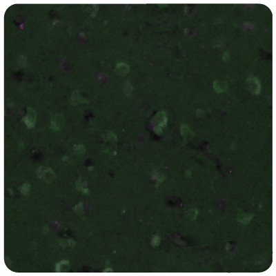 Multiplexed IHC-IF staining of human normal cortex samples using Anti-EZH2 monoclonal (Product No. AMAb91750) and Anti-SGO2 polyclonal (Product No. HPA035163) antibodies.