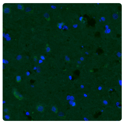 Immunostaining with fluorescence immunohistochemistry of human normal cortex tissue samples stained with the Anti-CHI3L1 antibody (Product No. AMAb91777).