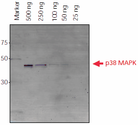 Detection of Histidine-Tagged Proteins after Western Blot Transfer Detection of Histidine-Tagged Proteins after Western Blot Transfer