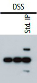 Western Blot Analysis of Immunoprecipitation (IP-Western) In a cross-linking IP western, the heavy and light chains of the primary capture antibody are excluded from the sample.