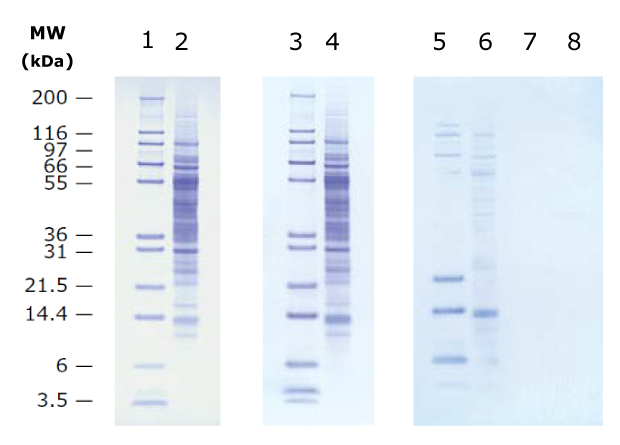 Electrotransfer of proteins using Immobilon membranes Imaging of membranes with molecular weight standards and lysate samples. On left, Immobilon-P membrane. In center, Immobilon=PSQ membrane. At right, Immobilon-P backup membrane in first two lanes and Immobilon-PSQ backup membrane in second two lanes. The left and center blots show similar protein profiles. The blot on the right shows detected protein on the Immobilon-P backup membrane, but no protein detected on the Immobilon-PSQ membrane.