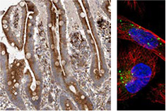 使用-抗-grn-抗体-的-ihc-分析 使用-抗-grn-抗体-的-ihc-分析