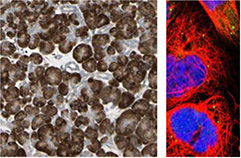 人-胰腺-组织-的-ihc-染色 人-胰腺-组织-的-ihc-染色