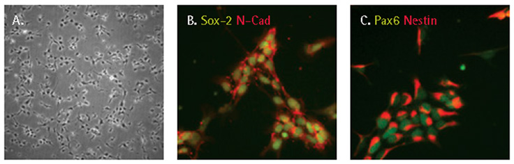 Characterization of iPSC derived neural progenitor cells Characterization of iPSC derived neural progenitor cells