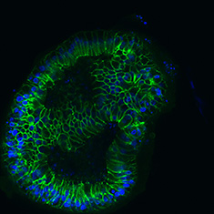 E-Cad/DAPI