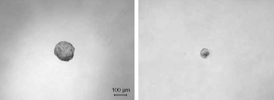 Expected results from an in vitro spheroid formation assay