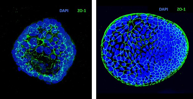 Generation of apical-out organoids Generation of apical-out human colon organoids