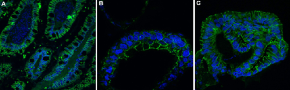 Human Colon Organoid and Small Intestine Tissue Sections All three images show thick lines of cytoplasmic and membranous staining for the organoid sections along with small ovals within the thick lines that represent the nucleus.