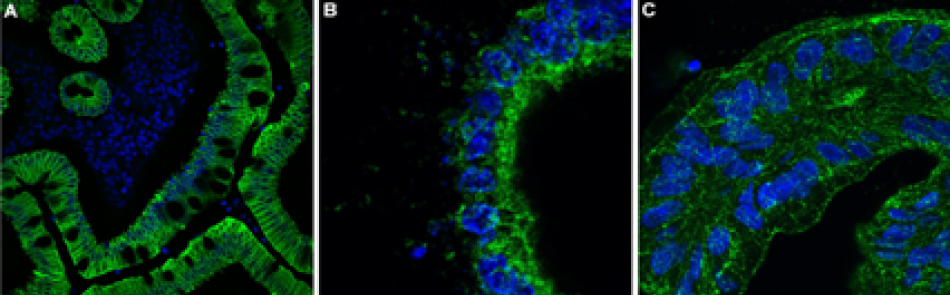 Human Small Intestine Tissue and Colon Organoid Sections All three images show thick lines of cytoplasmic and membranous staining for the organoid sections along with small ovals within the thick lines that represent the nucleus.