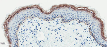 Neonatal Skin Tissue d <b>D</b>. Neonatal Skin Tissue