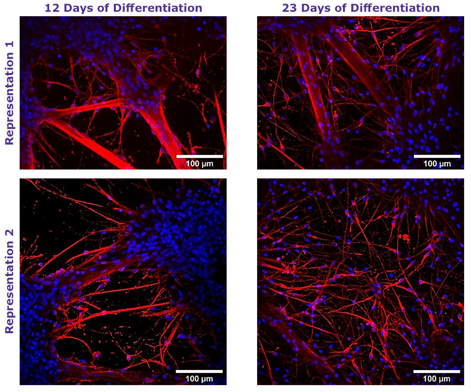 Neural Differentiation of Human NSCs using TrueGel3D HTS Hydrogel Plates Microscopy images of human NSCs cultured in 3D using TrueGel3D HTS hydrogel plates