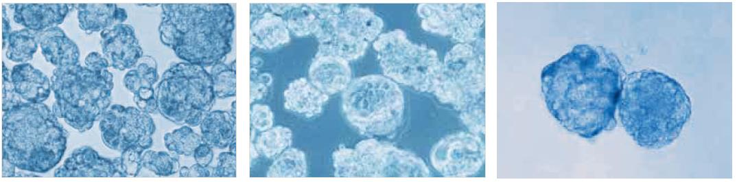 Tumorsphere culture of MCF-7 breast cancer cells in the PromoCell 3D Tumorsphere Media XF after 10 passages