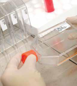 Subculture of adherent cell mono layer 细胞单层
