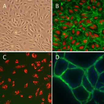 Human Umbilical Vein Endothelial Cells (HUVEC) 200-05n-cells