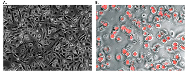 Morphology and phagocytic activity of human PBMC derived M1 macrophages 人PBMC来源M1巨噬细胞的形态和吞噬活性。
