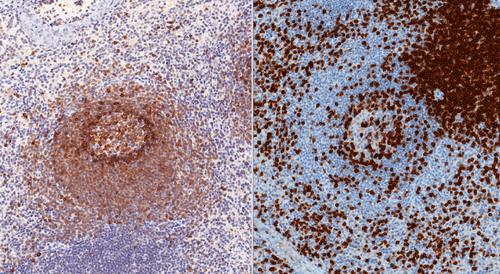 ihc-staining-spleen-cd79-cd3 免疫组织化学染色