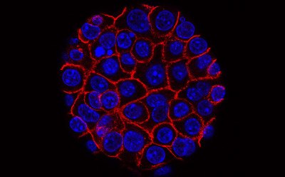 Flourescent cell cluster