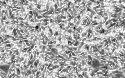 Cell culture by cell type