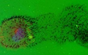 Cell migration