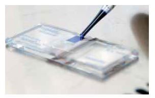 Cell counting using Trypan Blue dye and a hemocytometer