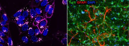 Live-cell imaging and analysis 