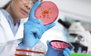 Female microbiologist wearing white lab coat, safety goggles and blue nitrile gloves examines a round petri dish with pink gel and red spots of bacteria.