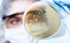 A laboratory technician is holding a petri dish containing a growth medium with several small yellow colonies visible on its surface. The technician is wearing blue latex gloves, and the background shows a blurred laboratory setting.