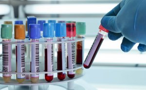 A gloved hand places a test tube holding a blood sample into a plastic laboratory test tube rack holding other blood samples with various colored lids.