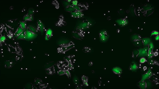 NK killing with anti-EGFR visualized by live cell imaging using the CellASIC® ONIX2 system